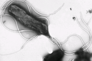 H. Pylori