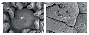 Peyers Patches and Microfold cells