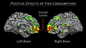 fish brain