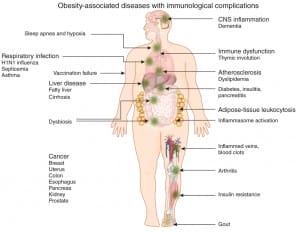 obesity and immunity