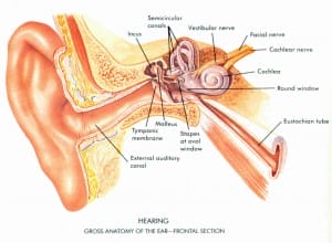 tinnitus